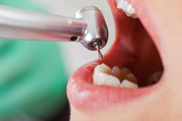 Best Walk-In Emergency Dentist in Aristocrat Ranchettes, CO